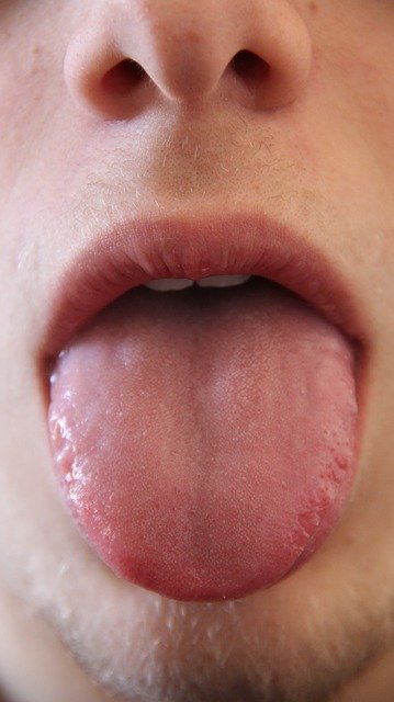 Hast du schon einmal etwas über Bänder im Mund gehört?